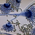 Aspergillus-flavus-under-microscope-570x377