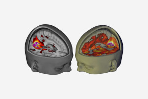 12-lsd-skull.w536.h357.2x